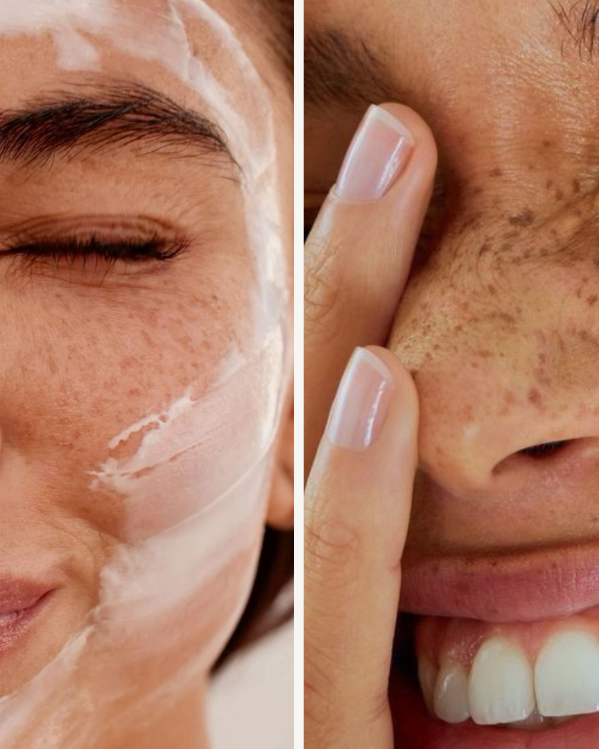 Your Skin Is Not the Problem. Here's What Actually Helps.